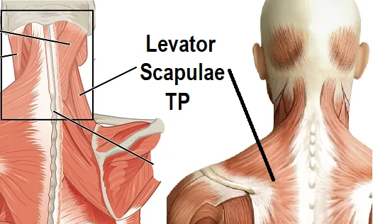 LIVE IN-PERSON 12 CE Hour Trigger Point & Neuromuscular Therapy Basics